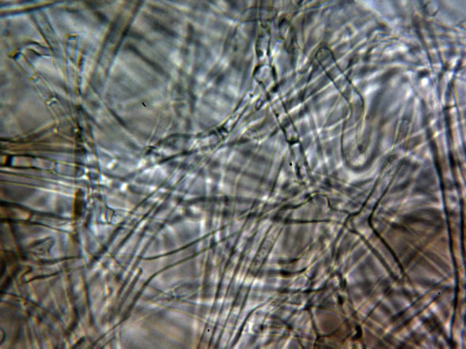 Microscopía de Russula acrifolia - 13 - Hifas cutícula